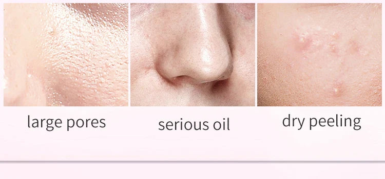 DR RASHEL Niconine Toner Refreshing Moisturizing Pore Reduction