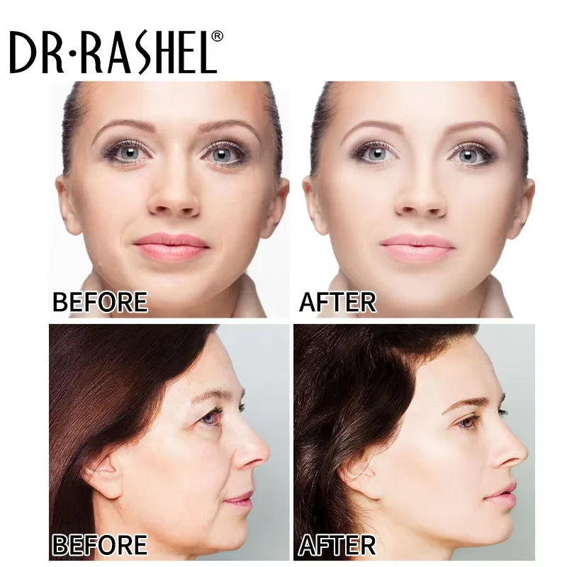 DR RASHEL VA Retinol Skin Rejuvenating Facial EssenceTo Lighten Dry Lines 30ML